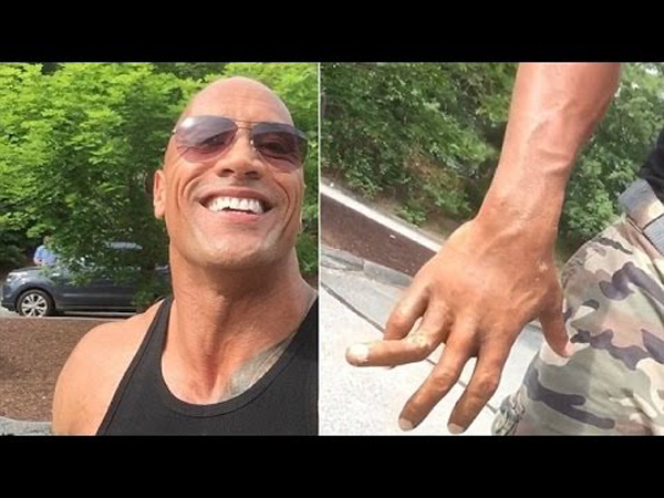 Dwayne 'The Rock' Johnson NASTY Finger Injury - Still Smiling!